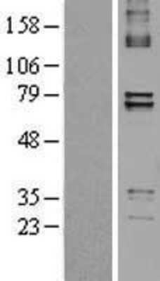 Western Blot: PTCD1 Overexpression Lysate [NBL1-14921]