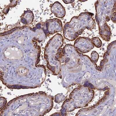 Immunohistochemistry-Paraffin: PTCD2 Antibody [NBP1-92303]