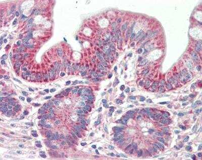 Immunohistochemistry-Paraffin: PTCD2 Antibody [NBP2-26176]