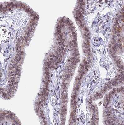 Immunohistochemistry-Paraffin: PTCHD4 Antibody [NBP1-84223]