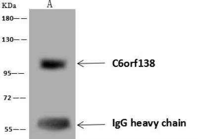 Immunoprecipitation: PTCHD4 Antibody [NBP3-12661]