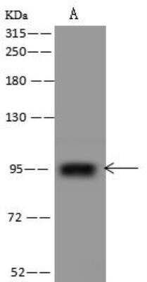 Western Blot: PTCHD4 Antibody [NBP3-12661]