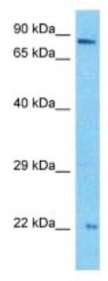 Western Blot: PTCRA Antibody [NBP3-09949]