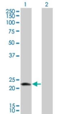Western Blot: PTD016 Antibody (4H7) [H00051136-M01]