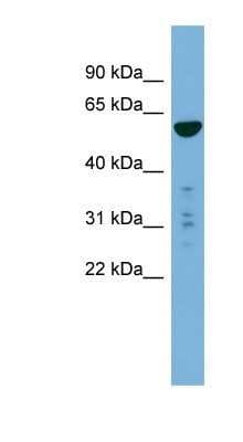 Western Blot: PTDSS2 Antibody [NBP1-91351]