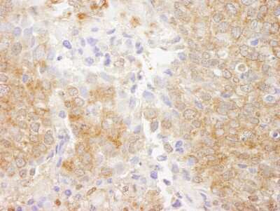 Immunohistochemistry-Paraffin: PTEN Antibody [NB100-2229]