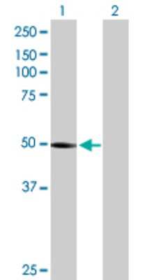 Western Blot: PTENP1 Antibody [H00011191-B01P]