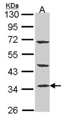 Western Blot: PTER Antibody [NBP1-32016]