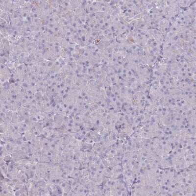 Immunohistochemistry-Paraffin: PTGDR Antibody [NBP3-17064]