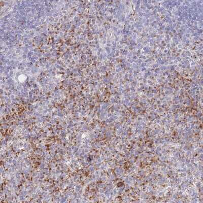 Immunohistochemistry-Paraffin: PTGDR Antibody [NBP3-17064]