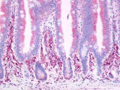 Immunohistochemistry-Paraffin: PTGDR Antibody - BSA Free [NLS503]