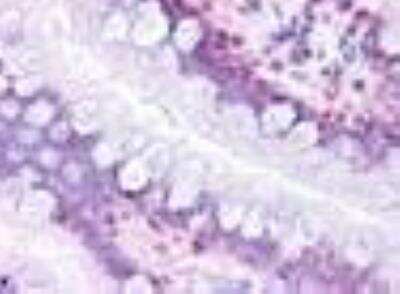 Immunohistochemistry-Paraffin: PTGDR Antibody - BSA Free [NLS8133]
