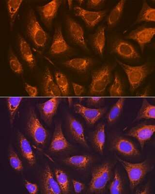 Immunocytochemistry/ Immunofluorescence: PTGER2 Antibody (2G10L6) [NBP3-16740]