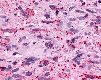 Immunohistochemistry-Paraffin: PTGER3 Antibody - BSA Free [NLS975]