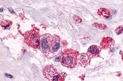 Immunohistochemistry-Paraffin: PTGER3 Antibody - BSA Free [NLS975]