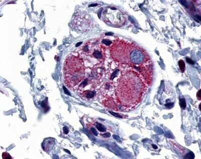 Immunohistochemistry-Paraffin: PTGER4/EP4 Antibody - BSA Free [NLS3890]
