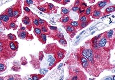Immunohistochemistry-Paraffin: PTGER4/EP4 Antibody - BSA Free [NLS3890]