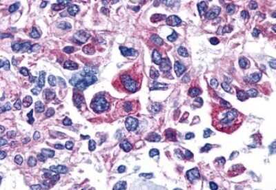 Immunohistochemistry-Paraffin: PTGER4/EP4 Antibody - BSA Free [NLS3890]