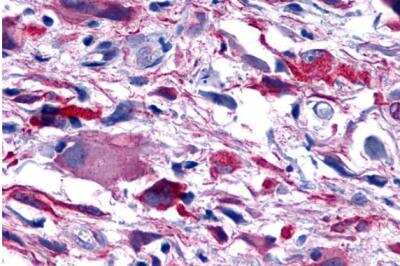 Immunohistochemistry-Paraffin: PTGER4/EP4 Antibody - BSA Free [NLS3890]