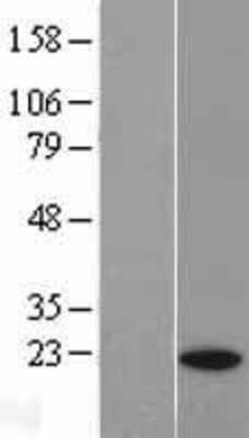 Western Blot: p23/PTGES3 Overexpression Lysate [NBL1-14937]