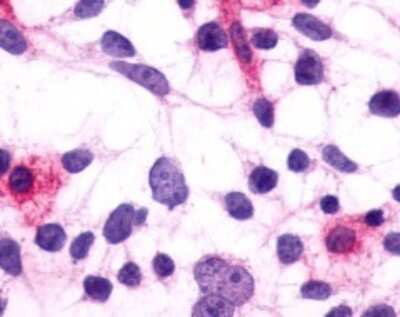 Immunohistochemistry-Paraffin: PTGFR Antibody - BSA Free [NLS1049]