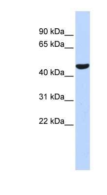 Western Blot: Prostaglandin I2 Synthase Antibody [NBP1-62390]