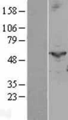 Western Blot: Prostaglandin I2 Synthase Overexpression Lysate [NBL1-14940]