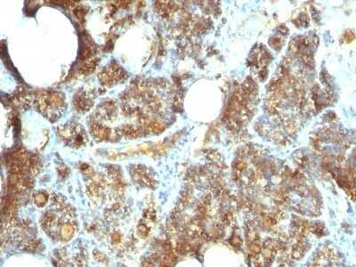 Immunohistochemistry-Paraffin: PTH Antibody (PTH/1173) - C-terminus - Azide and BSA Free [NBP2-47728]