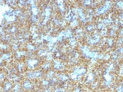 Immunohistochemistry-Paraffin: PTH Antibody (PTH/1174) - C-terminus - Azide and BSA Free [NBP2-47729]