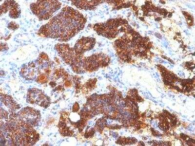 Immunohistochemistry-Paraffin: PTH Antibody (PTH/1175) - C-terminus - IHC-Prediluted [NBP2-48403]
