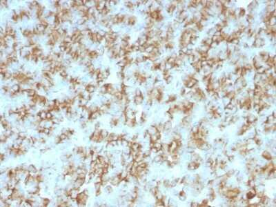 Immunohistochemistry-Paraffin: PTH Antibody (PTH/911) - N-terminal - IHC-Prediluted [NBP2-48385]