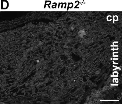 Immunohistochemistry: PTH1R/PTHR1 Antibody (3D1.1) [NBP1-40067]