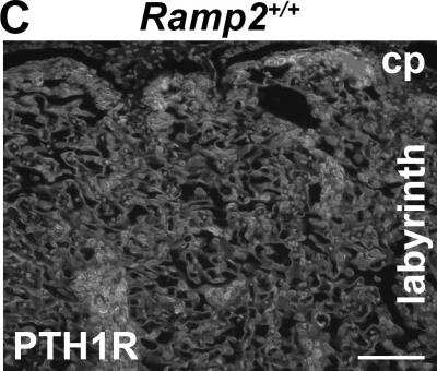 Immunohistochemistry: PTH1R/PTHR1 Antibody (3D1.1) [NBP1-40067]
