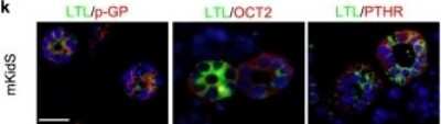 Immunocytochemistry/ Immunofluorescence: PTH1R/PTHR1 Antibody (4D2) - BSA Free [NBP1-51640]