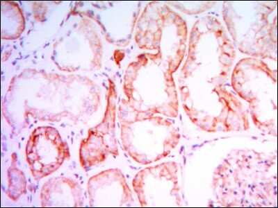 Immunohistochemistry-Paraffin: PTH1R/PTHR1 Antibody (4D2) - BSA Free [NBP1-51640]