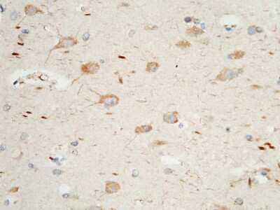 Immunohistochemistry-Paraffin: PTH1R/PTHR1 Antibody [NBP2-99962]