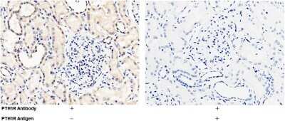 Immunohistochemistry-Paraffin: PTH1R/PTHR1 Antibody [NBP2-99962]