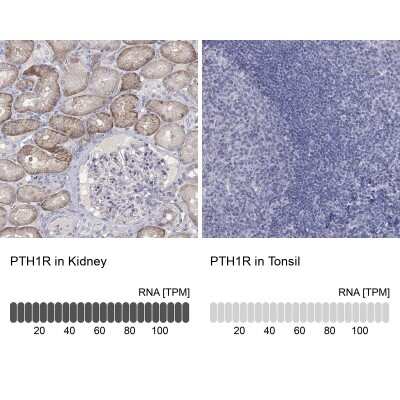 Immunohistochemistry-Paraffin: PTH1R/PTHR1 Antibody [NBP3-16996]