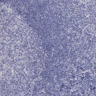 Immunohistochemistry-Paraffin: PTH1R/PTHR1 Antibody [NBP3-16996]