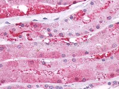 Immunohistochemistry-Paraffin: PTH1R/PTHR1 Antibody - BSA Free [NLS761]