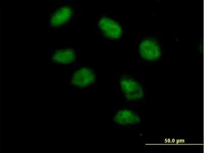 Immunocytochemistry/ Immunofluorescence: PTIP Antibody [H00022976-B01P]