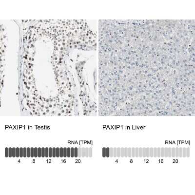 Immunohistochemistry-Paraffin: PTIP Antibody [NBP1-88233]