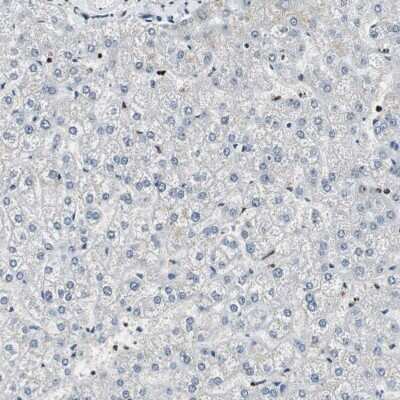 Western Blot: PTIP Antibody [NBP1-88233]