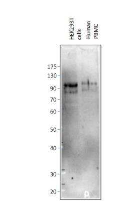 Western Blot: PTIP Antibody [NBP3-12230]