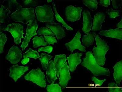 Immunocytochemistry/ Immunofluorescence: PTK7/CCK4 Antibody (4F5) [H00005754-M06]