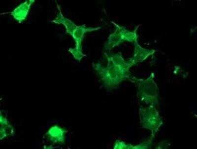 Immunocytochemistry/ Immunofluorescence: PTK7/CCK4 Antibody (OTI2E7) - Azide and BSA Free [NBP2-73708]