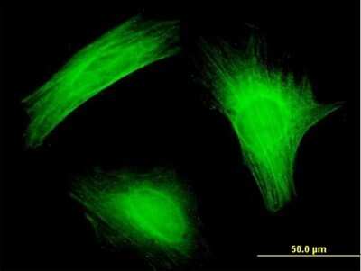 Immunocytochemistry/ Immunofluorescence: PTK9 Antibody (1D12) [H00005756-M05]