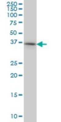 Western Blot: PTK9 Antibody (5C4) [H00005756-M06]