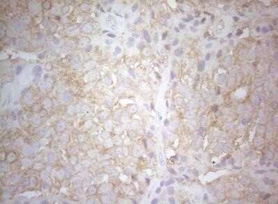 Immunohistochemistry: PTK9 Antibody (OTI5C12) - Azide and BSA Free [NBP2-73710]