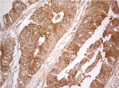 Immunohistochemistry: PTK9 Antibody (OTI5C12) - Azide and BSA Free [NBP2-73710]